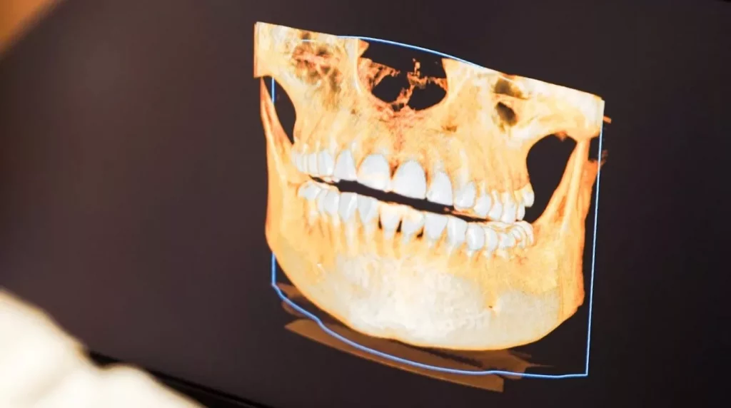5 Keunggulan Digital X-Ray dan CBCT untuk Pemeriksaan Gigi di Klinik Dental BSD, Apa Saja 3 5 Keunggulan Digital X Ray dan CBCT untuk Pemeriksaan Gigi di Klinik Dental BSD
