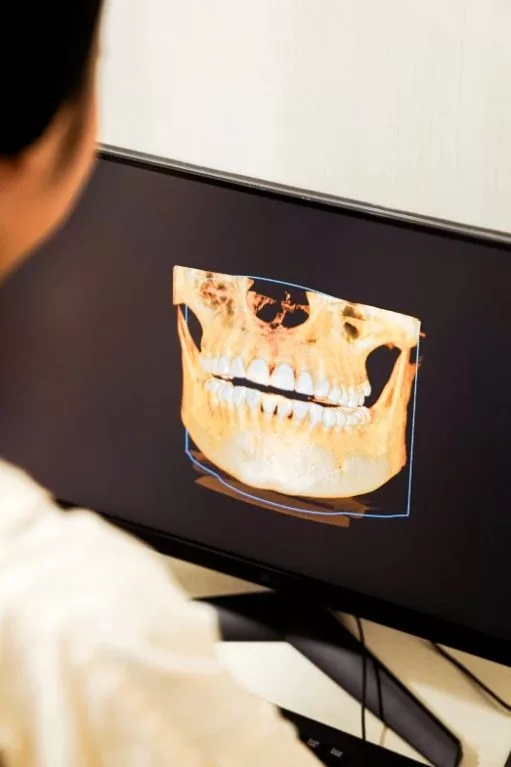 5 Keunggulan Digital X Ray dan CBCT untuk Pemeriksaan Gigi di Klinik Dental BSD 2