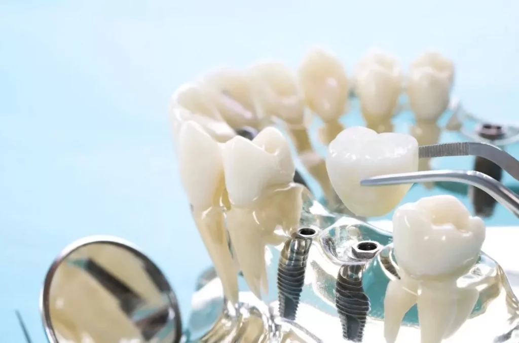 Implan VS Gigi Tiruan Penuh (Full Dentures) di Klinik Gigi BSD: Mana yang Cocok untuk Lansia? 1 gigi-tiruan-penuh-full-dentures-bsd