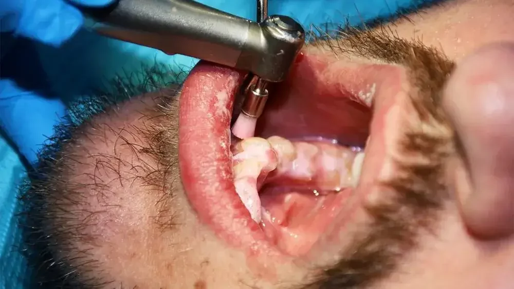 biaya scaling karang gigi banner