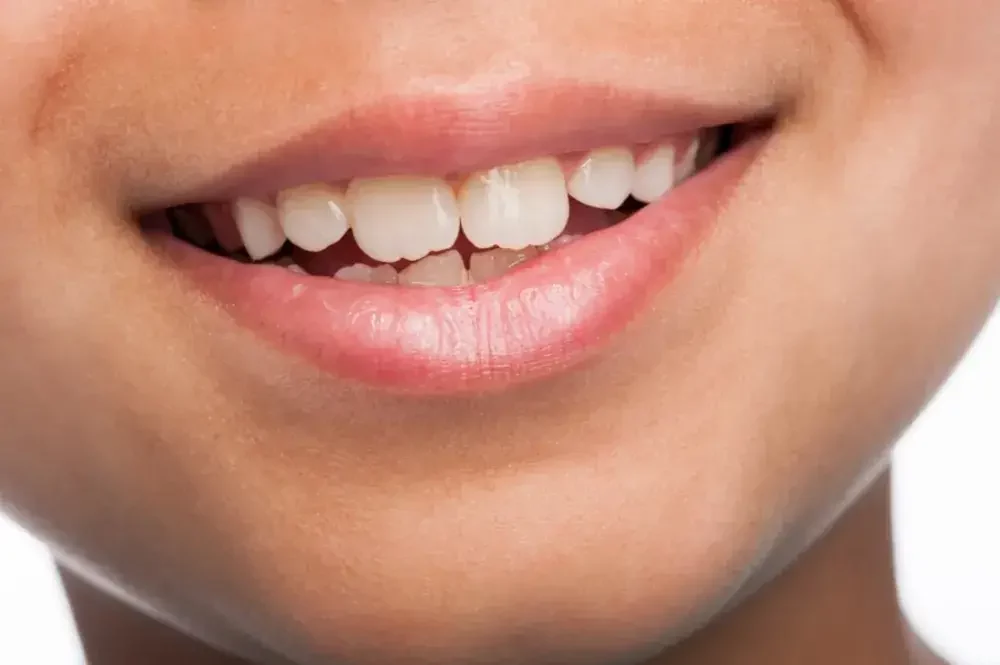 Kapan Tumbuh Gigi Permanen? Ini Tanda dan Prosesnya 5 gigi tumbuh permanen 1