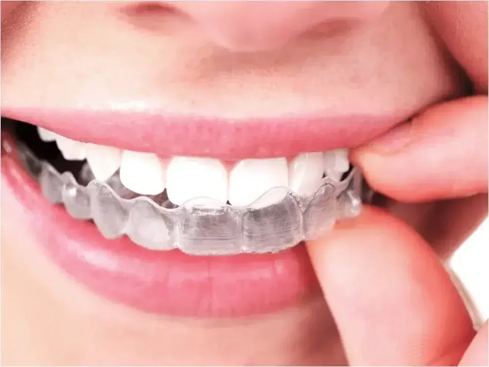 klinik invisalign