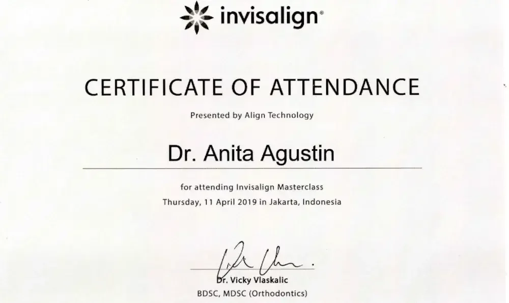 harga aligner gigi 2