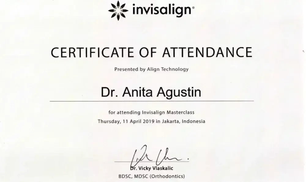 harga pemasangan invisalign 2