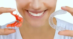 perbedaan aligner dan retainer 1