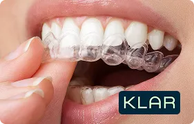 Klar Clear Aligner