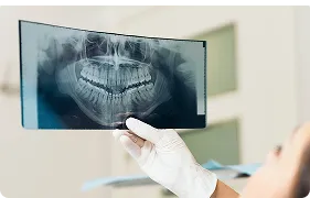 Panoramic X Ray 3