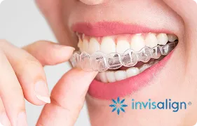 INVISALIGN