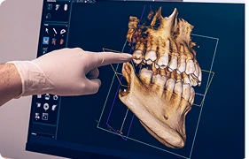 cbct 2