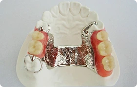 metal frame